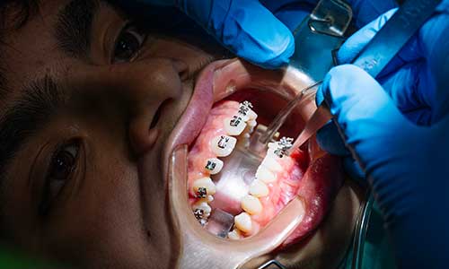 Orthodontic Treatment | Lumina Dental Clinic 